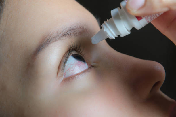 Imagen de ojo reseco y lágrimas artificiales
