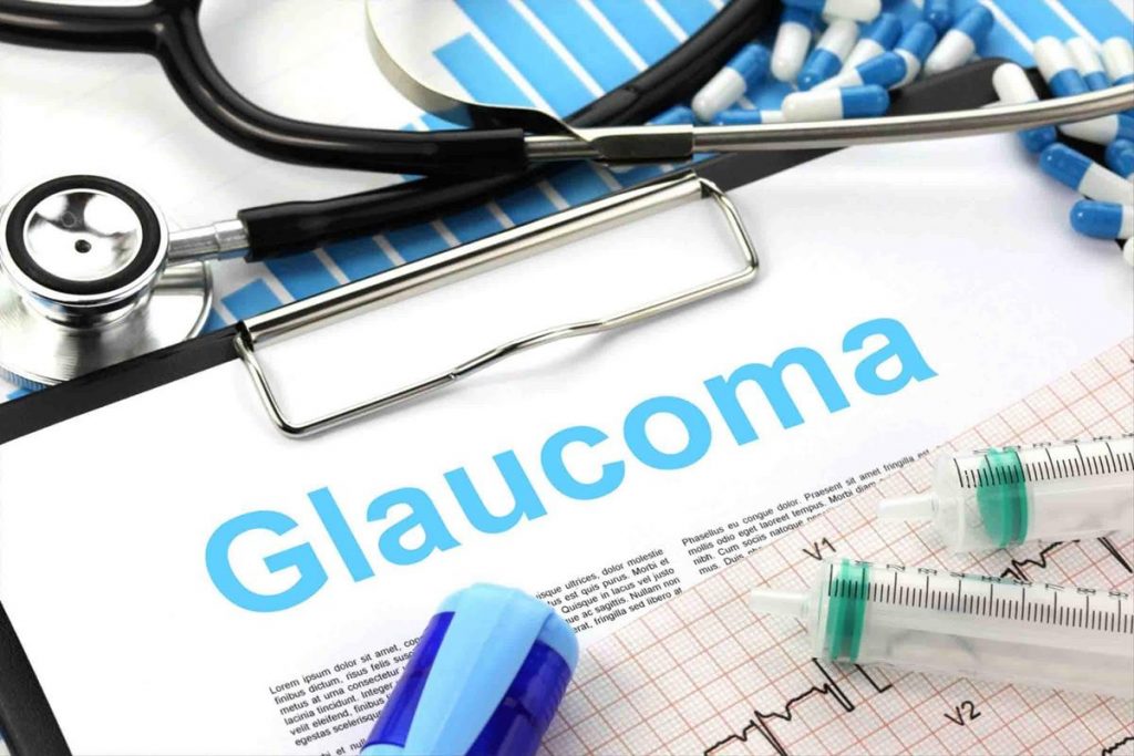 Imagen de Glaucoma